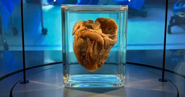 A patient who underwent a transplant felt her heart on display in the Museum |  Marie Claire